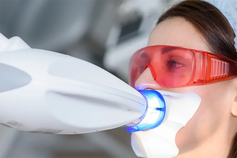 オフィスホワイトニング(上下前小臼歯16本 *かぶせ物は除く)